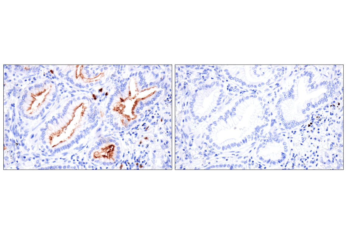 Immunohistochemistry Image 17: CD177 (F9O5U) Rabbit Monoclonal Antibody