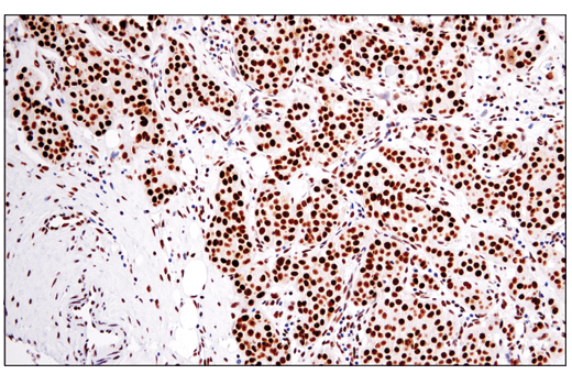 Immunohistochemistry Image 1: DNA-PKcs (E6U3A) Rabbit Monoclonal Antibody (BSA and Azide Free)
