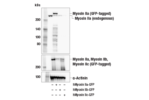 Western Blotting Image 2: Myosin IIa (E7Y9O) Rabbit Monoclonal Antibody