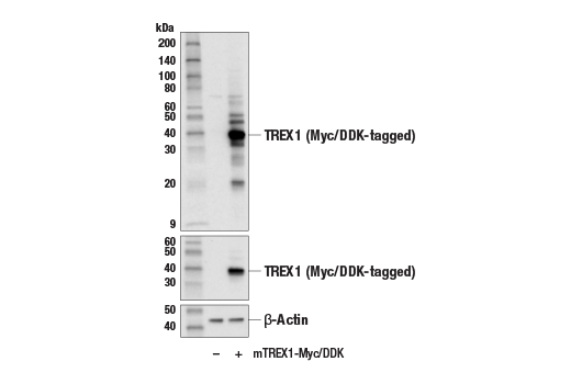 Western Blotting Image 2: TREX1 (E6D7M) Rabbit Monoclonal Antibody