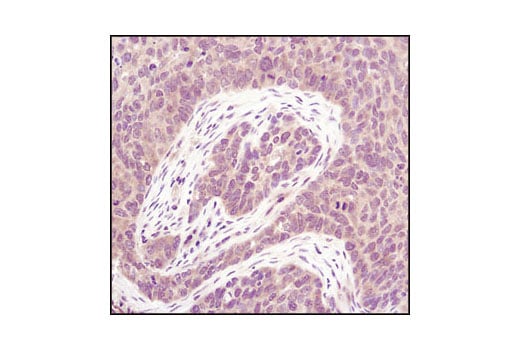 Immunohistochemistry Image 1: PP2A A Subunit (81G5) Rabbit Monoclonal Antibody
