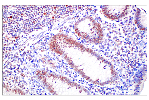 Immunohistochemistry Image 6: MLH1 (ES05) Mouse Monoclonal Antibody
