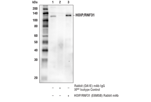 Immunoprecipitation Image 1: HOIP/RNF31 (E6M5B) Rabbit Monoclonal Antibody