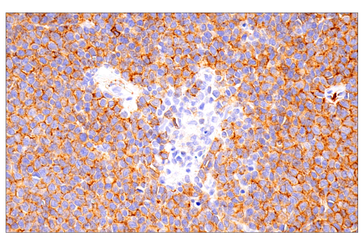 Immunohistochemistry Image 1: IgM (E9U8J) Rabbit Monoclonal Antibody