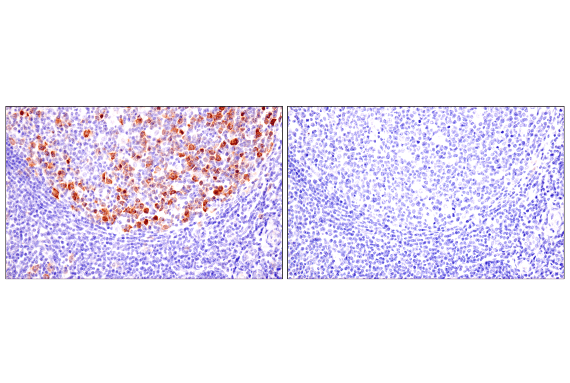 Immunohistochemistry Image 9: Cyclin B1 (F7U1O) Rabbit Monoclonal Antibody