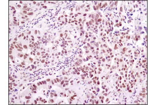 Immunohistochemistry Image 2: ERCC1 (D6G6) XP<sup>®</sup> Rabbit mAb