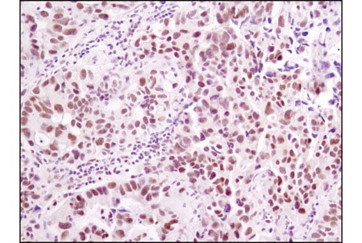 Immunohistochemistry Image 2: ERCC1 (D6G6) Rabbit Monoclonal Antibody
