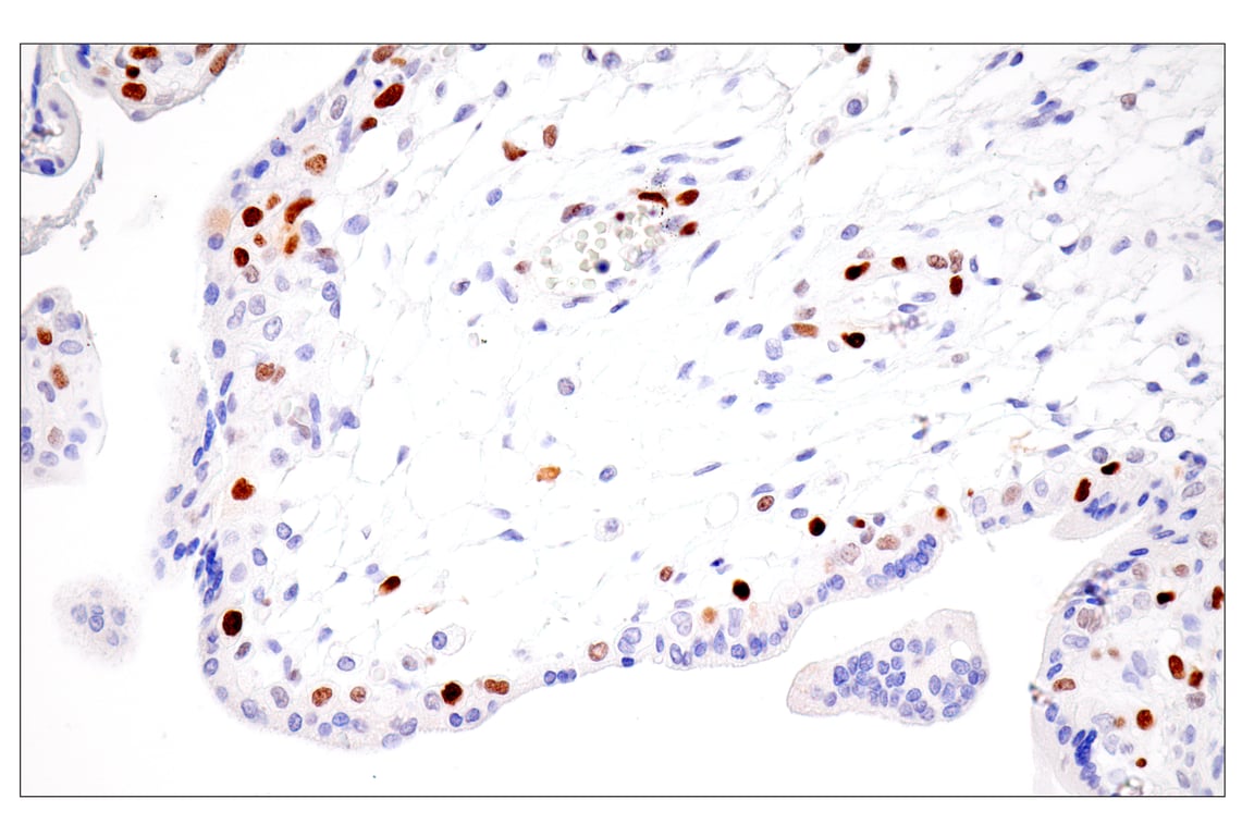 Immunohistochemistry Image 13: UHRF1 (E5W8W) Rabbit Monoclonal Antibody