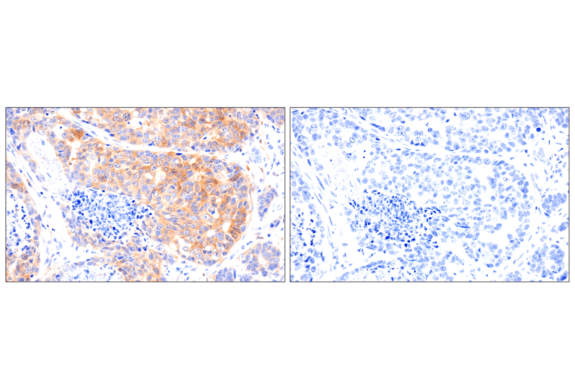 Immunohistochemistry Image 11: FAK (F7Z4C) Mouse Monoclonal Antibody