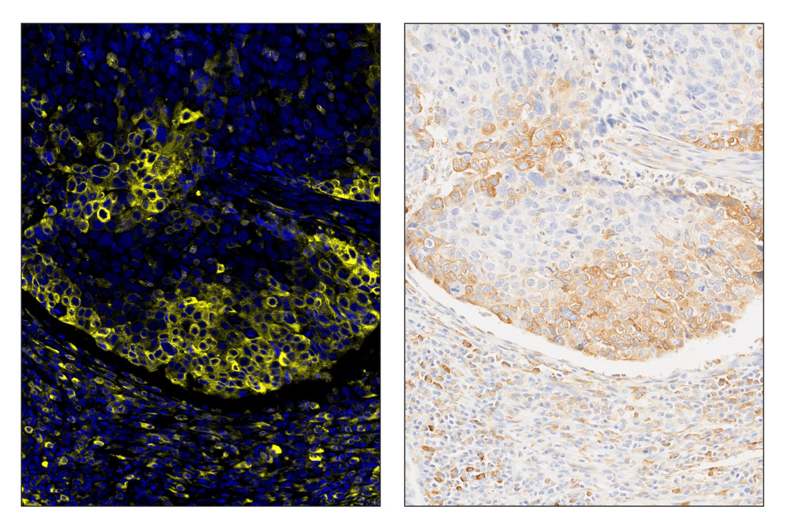 Immunohistochemistry Image 5: Phospho-S6 Ribosomal Protein (Ser235/236) (D57.2.2E) & CO-0107-488 SignalStar<sup>™</sup> Oligo-Antibody Pair