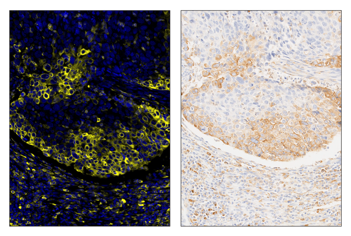 Immunohistochemistry Image 5: Phospho-S6 Ribosomal Protein (Ser235/236) (D57.2.2E) & CO-0107-750 SignalStar<sup>™</sup> Oligo-Antibody Pair