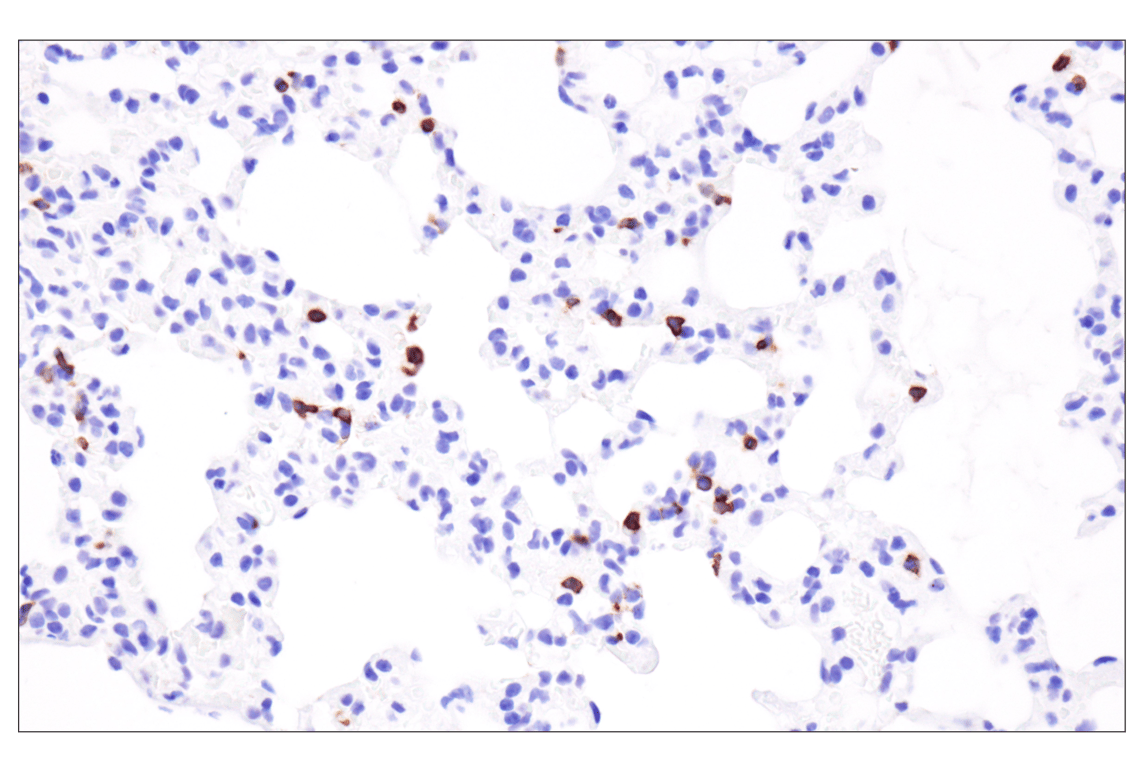 Immunohistochemistry Image 5: CD79A (F3Z1H) Rabbit Monoclonal Antibody