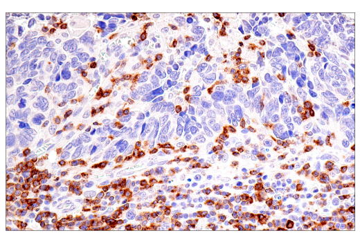 Immunohistochemistry Image 2: CD7 (LP15) Mouse mAb