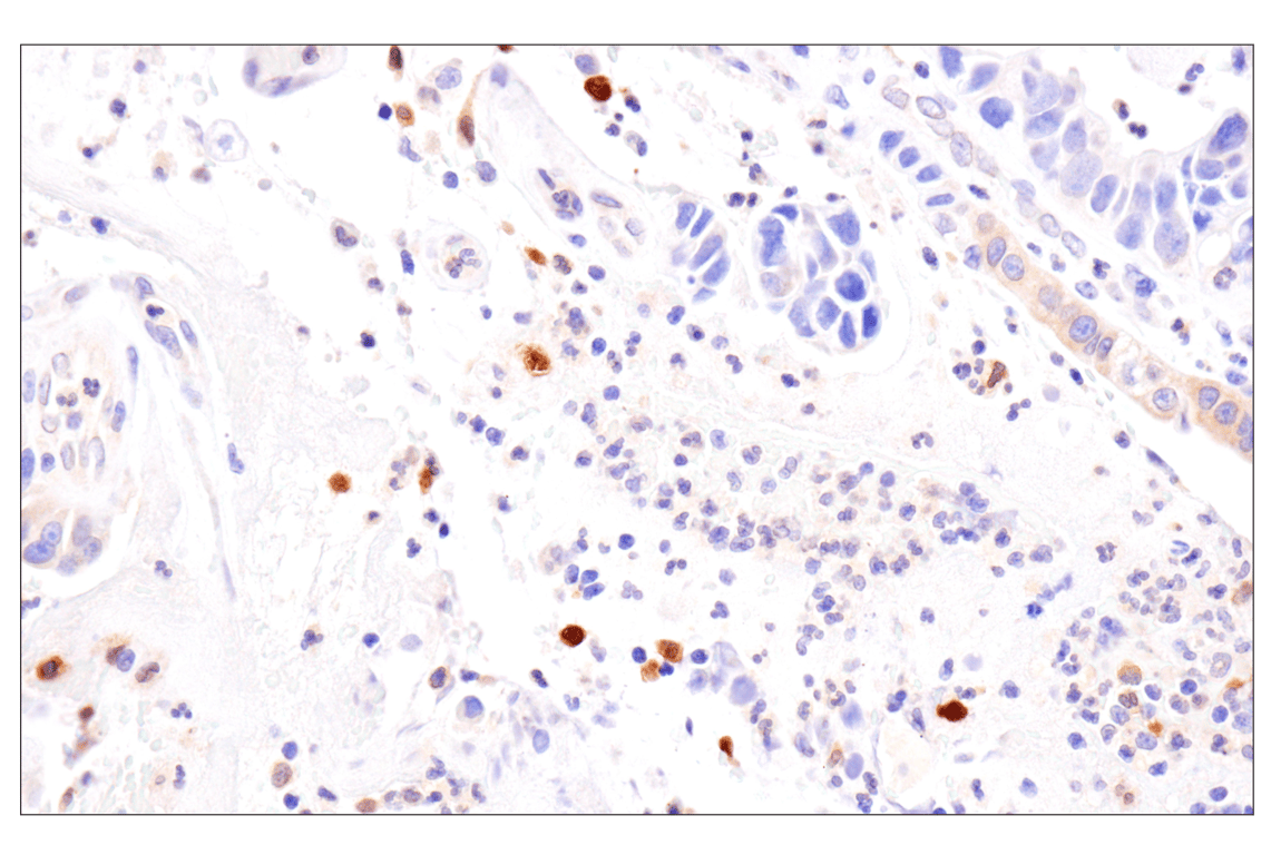 Immunohistochemistry Image 4: APOBEC3A (UMN-13) Rabbit Monoclonal Antibody