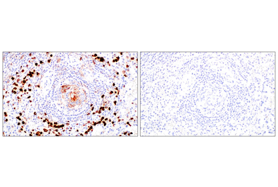 Immunohistochemistry Image 15: CD11b/ITGAM (E3J2F) Rabbit Monoclonal Antibody