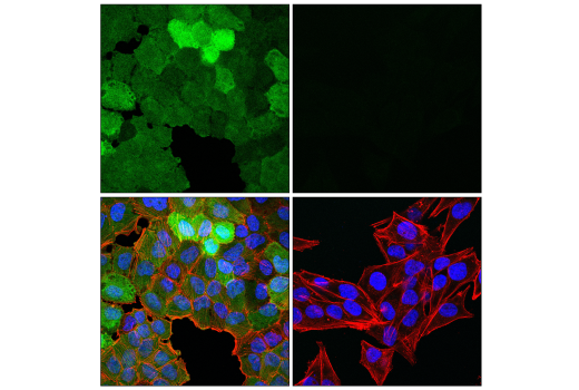 Immunofluorescence Image 1: UCHL1 (E6B8E) Mouse Monoclonal Antibody