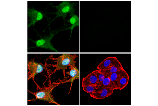 Immunofluorescence Image 1: S100B (E7C3A) Rabbit Monoclonal Antibody (BSA and Azide Free)