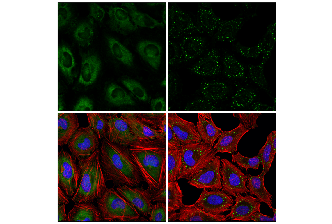 Immunofluorescence Image 1: G3BP2 (F3Y7Z) Mouse Monoclonal Antibody