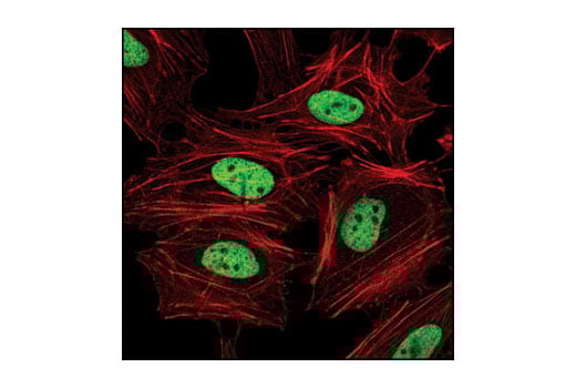 Immunofluorescence Image 1: Di-Methyl-Histone H3 (Lys4) (C64G9) Rabbit Monoclonal Antibody