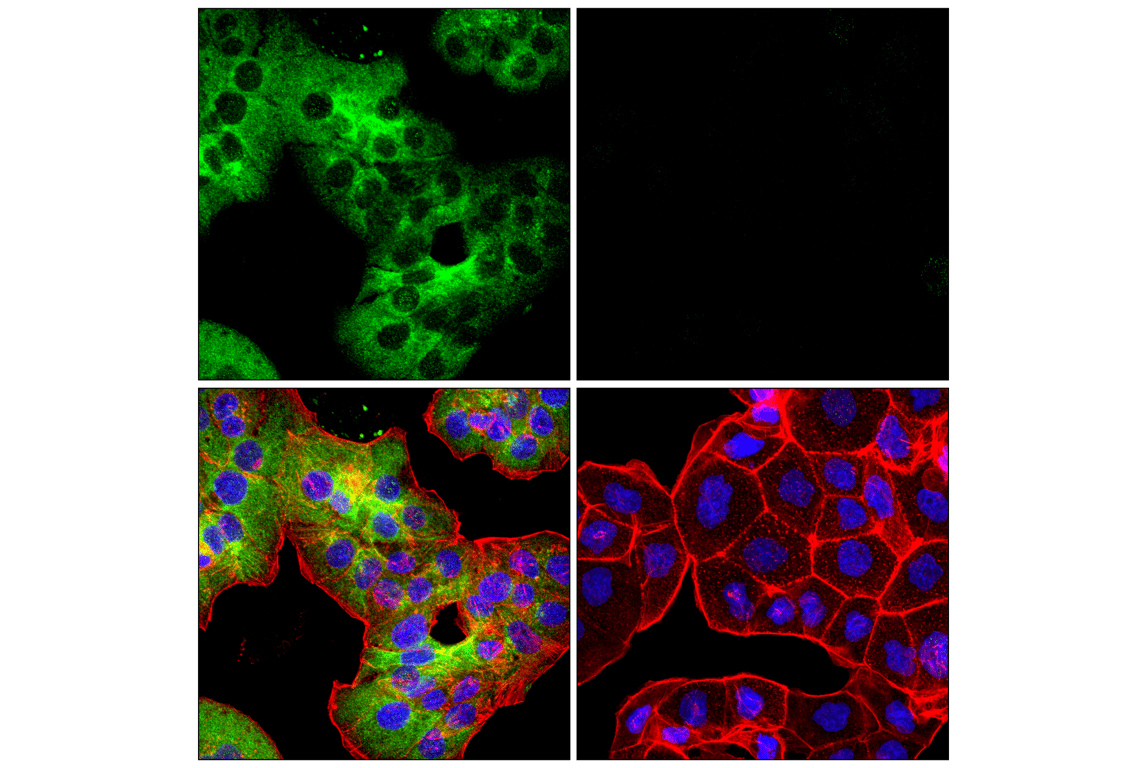 Immunofluorescence Image 1: WNK1 (F1O3U) Rabbit Monoclonal Antibody