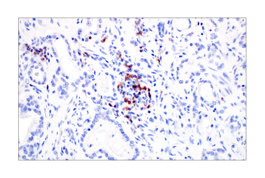 Immunohistochemistry Image 8: TIGIT (E5Y1W) Rabbit Monoclonal Antibody