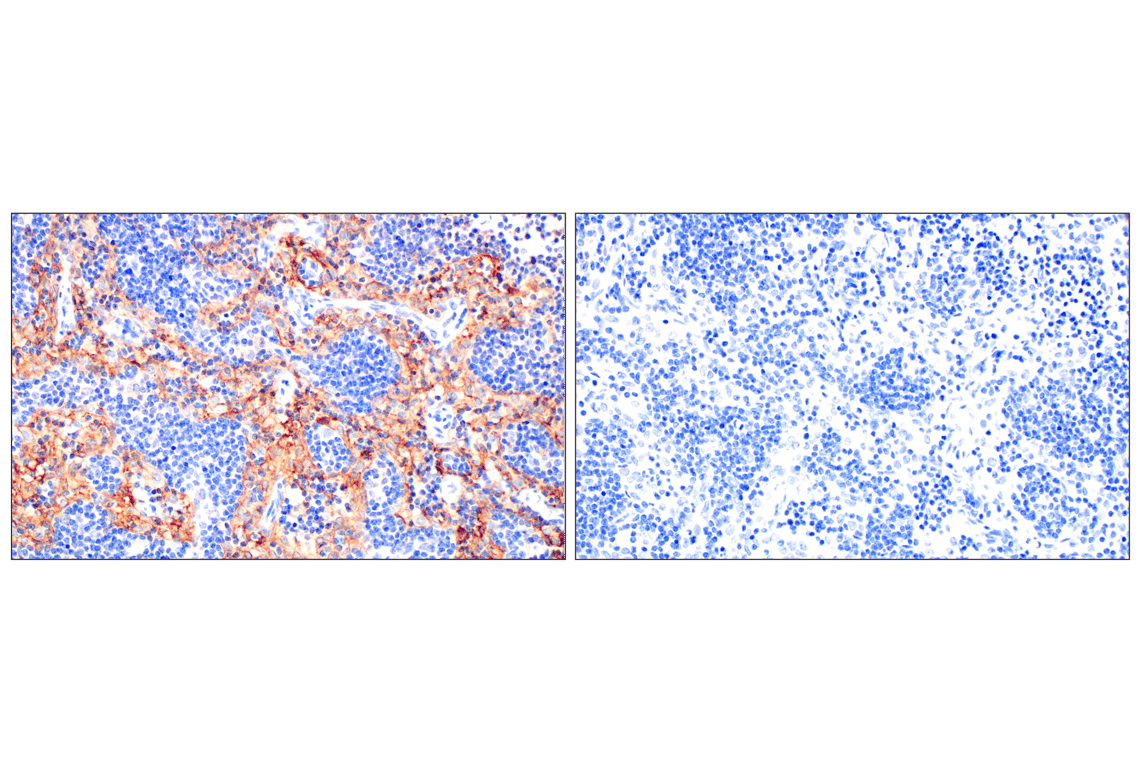 Immunohistochemistry Image 10: Neuropilin-2 (E5Q2G) Rabbit Monoclonal Antibody