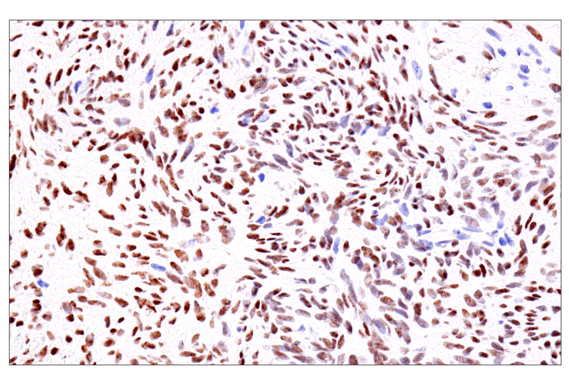 Immunohistochemistry Image 11: GATA-6 (D61E4) Rabbit Monoclonal Antibody