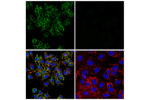 Immunofluorescence Image 1: CSF-1R/M-CSF-R (E6W9F) Rabbit Monoclonal Antibody
