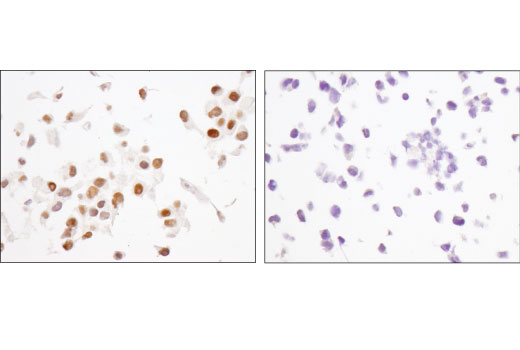 Immunohistochemistry Image 3: CHD5 (D2F9Q) Rabbit Monoclonal Antibody