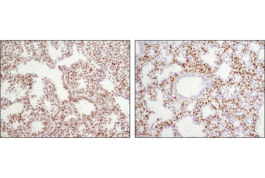 undefined Image 30: Notch Activated Targets Antibody Sampler Kit