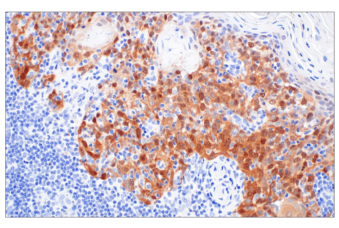 Immunohistochemistry Image 4: p16 INK4A (F9T1L) Rabbit Monoclonal Antibody