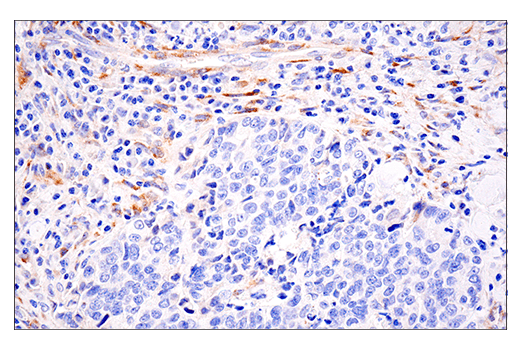 Immunohistochemistry Image 3: LOXL2 (E3P7Y) Rabbit Monoclonal Antibody