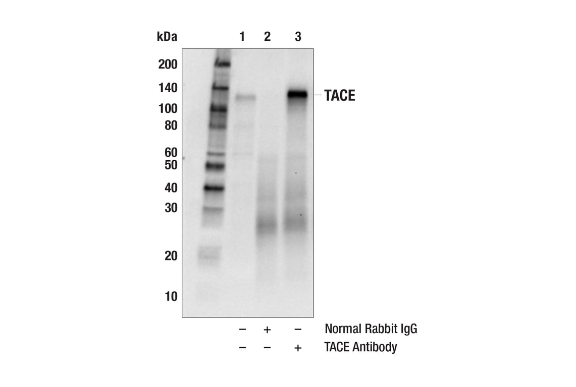 Immunoprecipitation Image 1: TACE Antibody