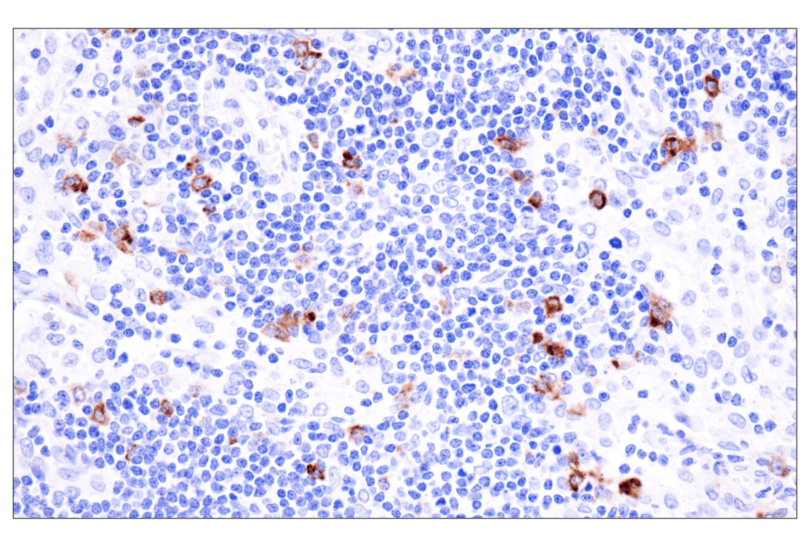 Immunohistochemistry Image 6: Langerin (F8L8I) Rabbit Monoclonal Antibody