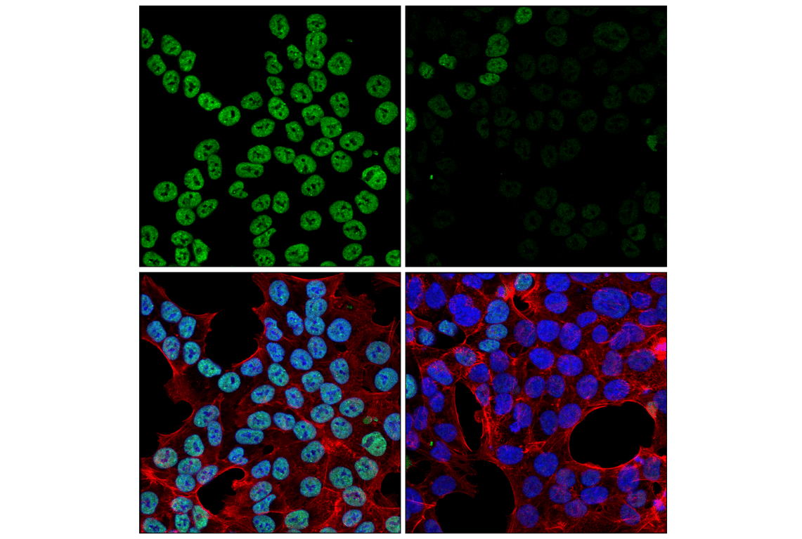 Immunofluorescence Image 1: SAFB1 (F5Z6A) Rabbit Monoclonal Antibody