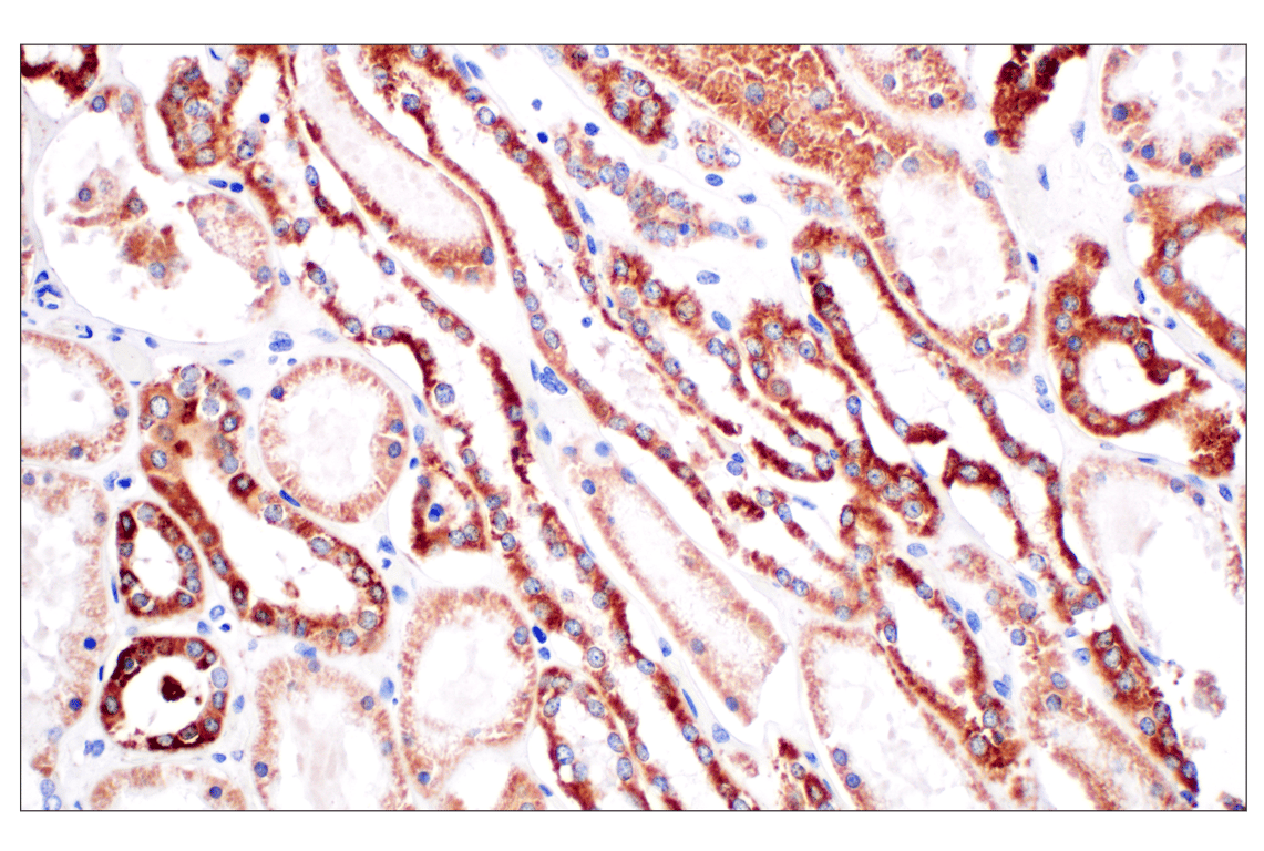 Immunohistochemistry Image 5: CPT1A (E3Y1V) Rabbit Monoclonal Antibody