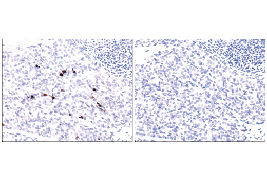 Immunohistochemistry Image 1: Cleaved Caspase-3 (Asp175) (5A1E) Rabbit Monoclonal Antibody (BSA and Azide Free)