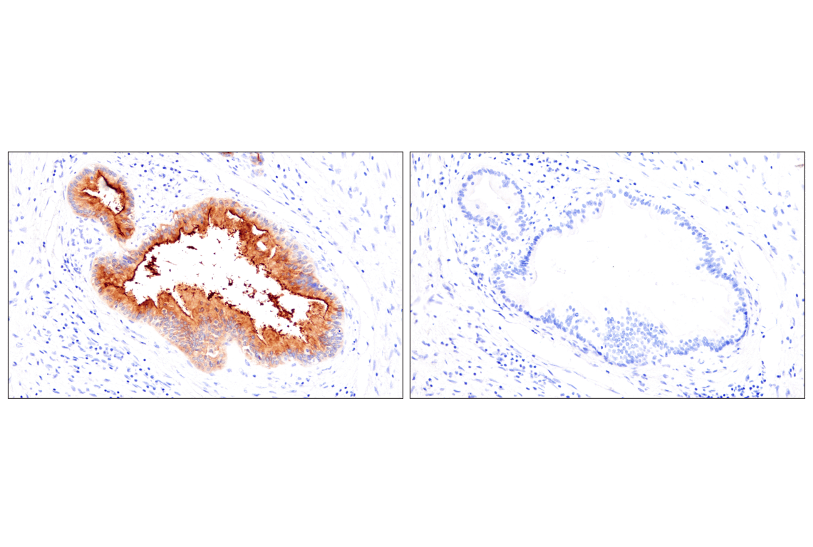 Immunohistochemistry Image 11: CEACAM7 (E5Q6X) Rabbit Monoclonal Antibody (BSA and Azide Free)