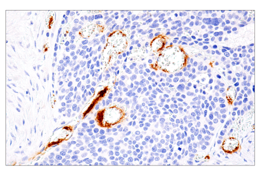 Immunohistochemistry Image 2: DNAM-1/CD226 (E8L9G) Rabbit Monoclonal Antibody (BSA and Azide Free)