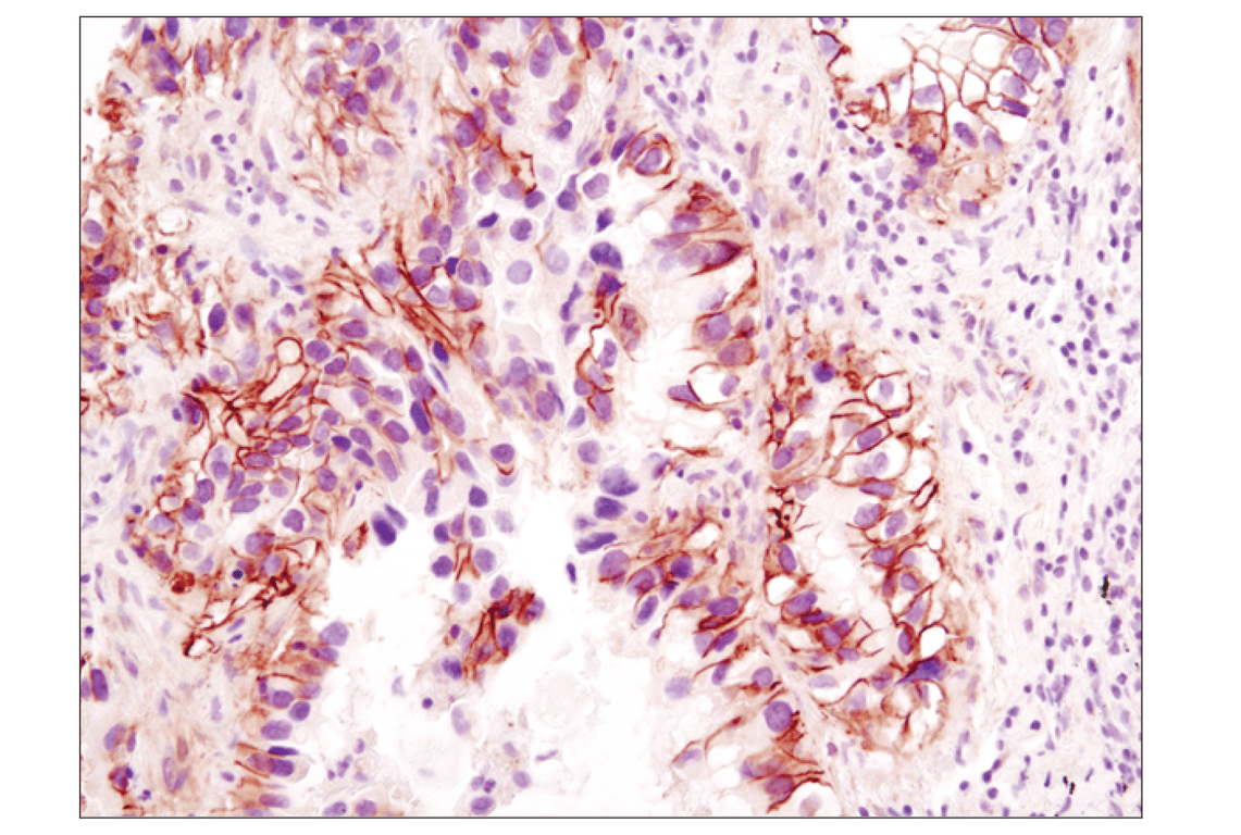 Immunohistochemistry Image 2: beta-Catenin (D10A8) Rabbit Monoclonal Antibody