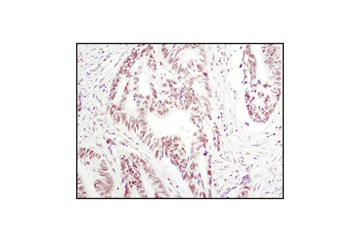 Immunohistochemistry Image 1: Phospho-p38 MAPK (Thr180/Tyr182) (D3F9) Rabbit Monoclonal Antibody (BSA and Azide Free)