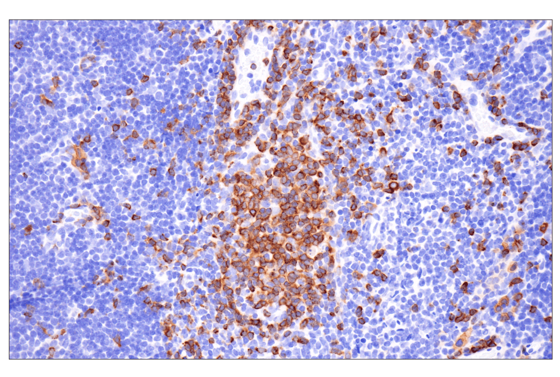 Immunohistochemistry Image 3: CD79A (F3Z1H) Rabbit Monoclonal Antibody