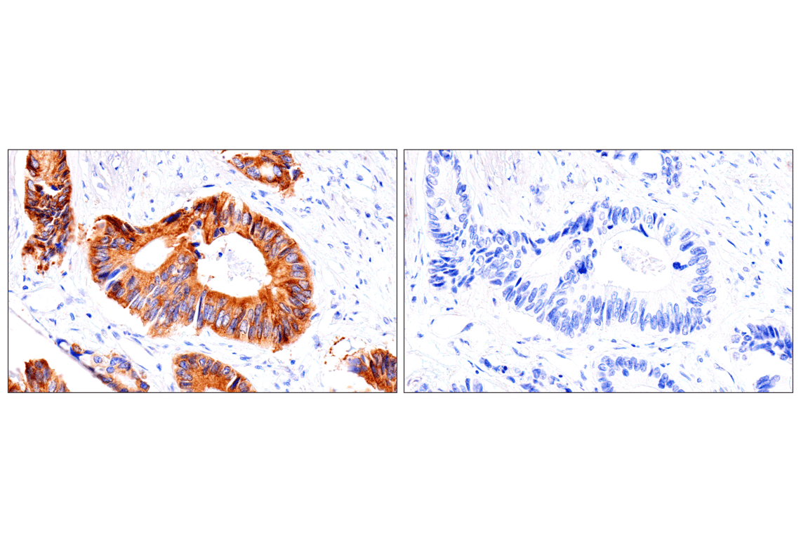 Immunohistochemistry Image 11: ENTPD5 (E5U3V) Rabbit Monoclonal Antibody