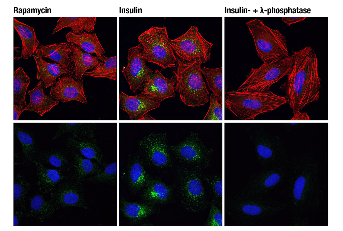 Immunofluorescence Image 1: Phospho-mTOR (Ser2448) (D9C2) Rabbit Monoclonal Antibody (BSA and Azide Free)