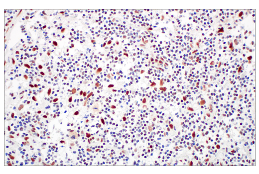 undefined Image 34: ATM Substrates Antibody Sampler Kit