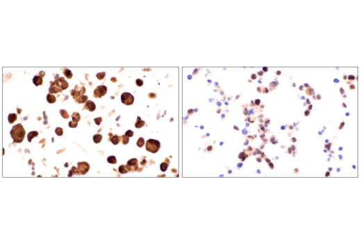 Immunohistochemistry Image 7: CDK2 (E8J9T) Rabbit Monoclonal Antibody (BSA and Azide Free)
