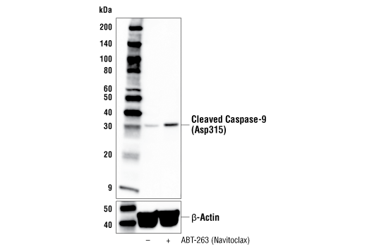 undefined Image 1: ABT-263 (Navitoclax)