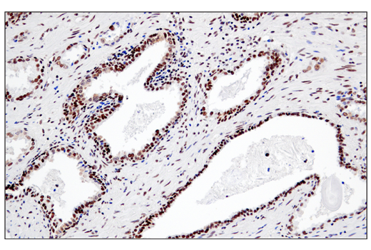 Immunohistochemistry Image 6: RPA32/RPA2 (E8X5P) XP<sup>®</sup> Rabbit mAb
