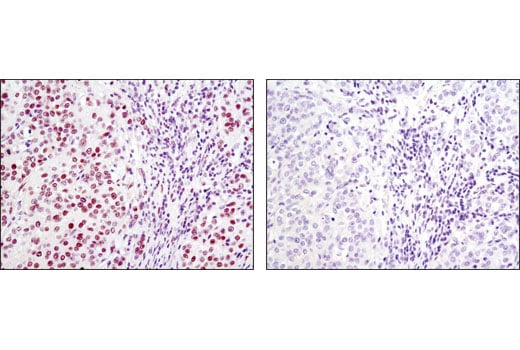 Immunohistochemistry Image 1: FoxP1 (D35D10) Rabbit Monoclonal Antibody (BSA and Azide Free)