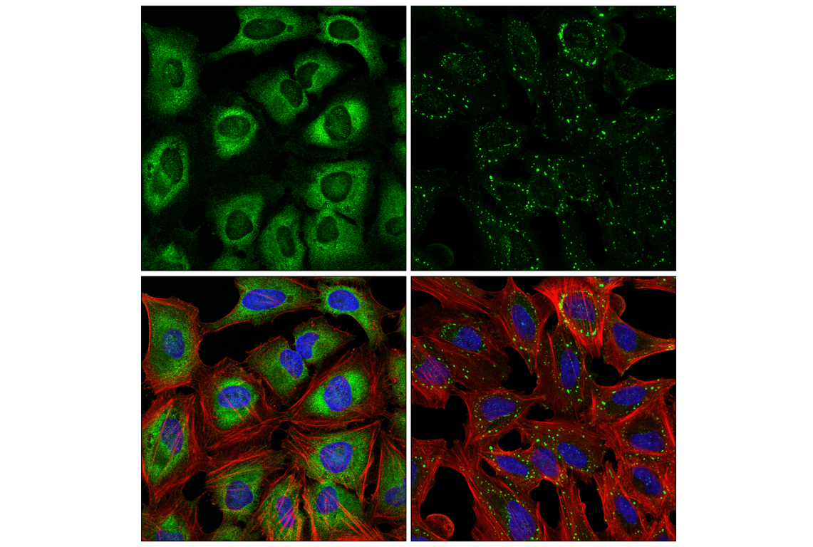 Immunofluorescence Image 2: YTHDF3 (E2J9I) Rabbit Monoclonal Antibody